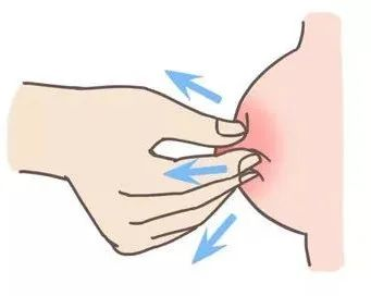 大乳頭、小乳頭、扁平乳頭、凹陷乳頭3大喂養(yǎng)指導及護理指南！