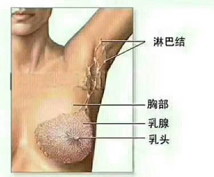 哺乳期乳腺炎癥狀和預防及治療方法