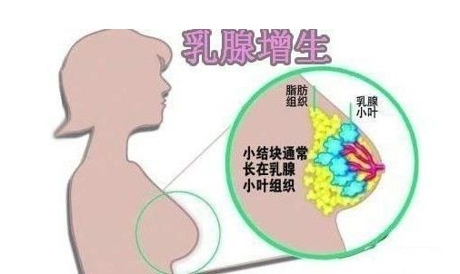 乳房出現(xiàn)“青筋”是什么原因呢？