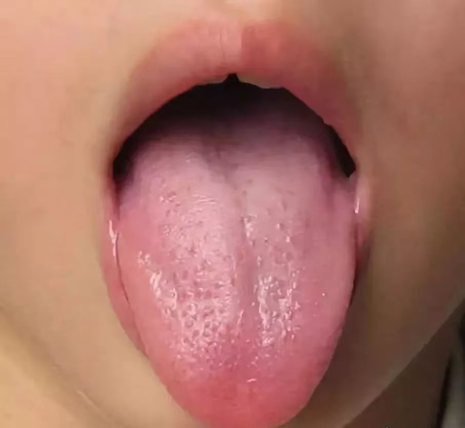 過(guò)度喂養(yǎng)危害大，寶寶發(fā)出的積食信號(hào)你能看懂多少？