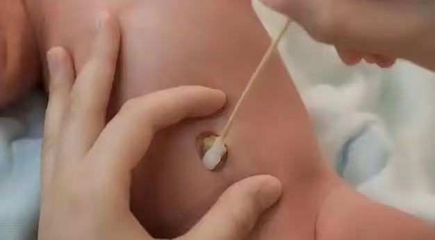  肚臍眼里的污垢，到底能不能摳？ 