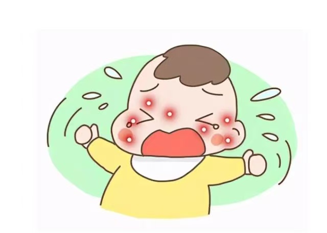 孩子濕疹反復(fù)發(fā)作怎么辦？這些防治方法請(qǐng)收好！